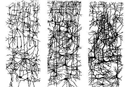05 vetvenie neuronov big image